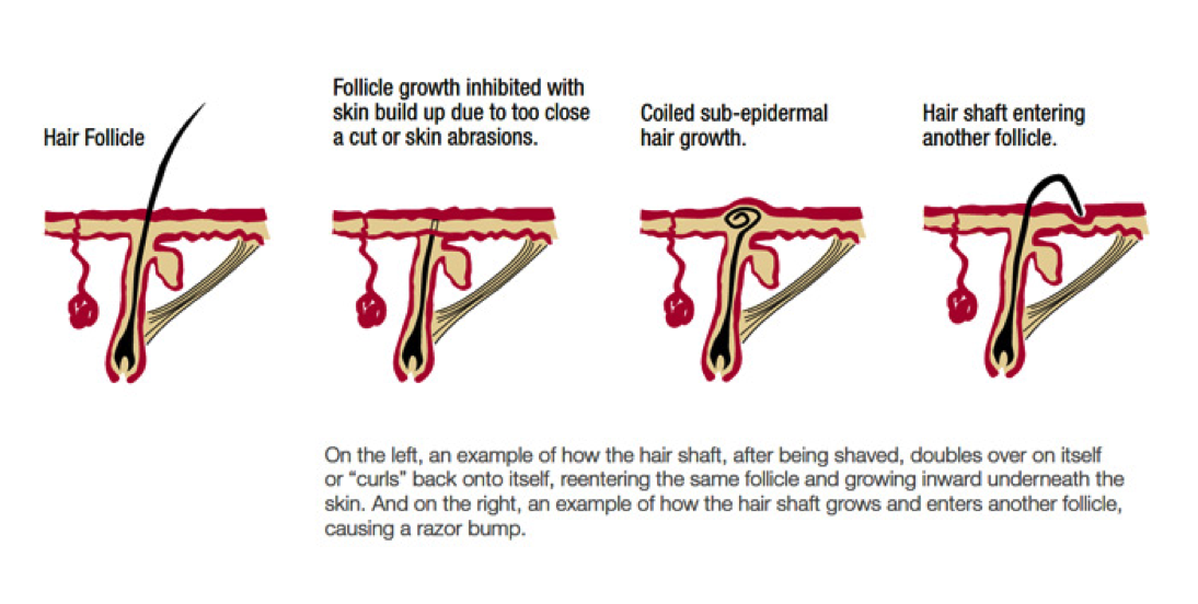 Figure 2.( Photo credit: www.therefinededit.com)