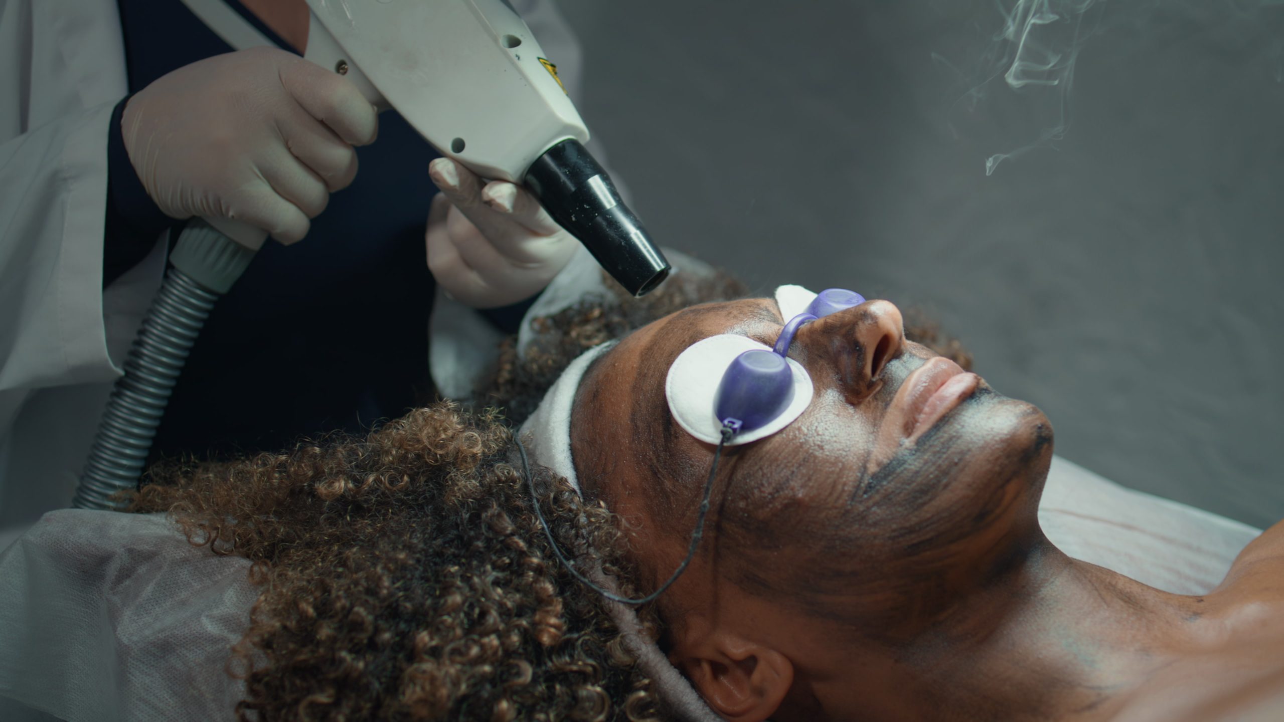 Laser treatments at Skin101